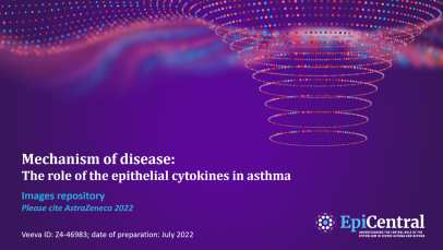 Role of epithelial cytokines in asthma
