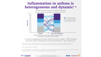 Overlapping inflammatory pathways in severe asthma - infographic