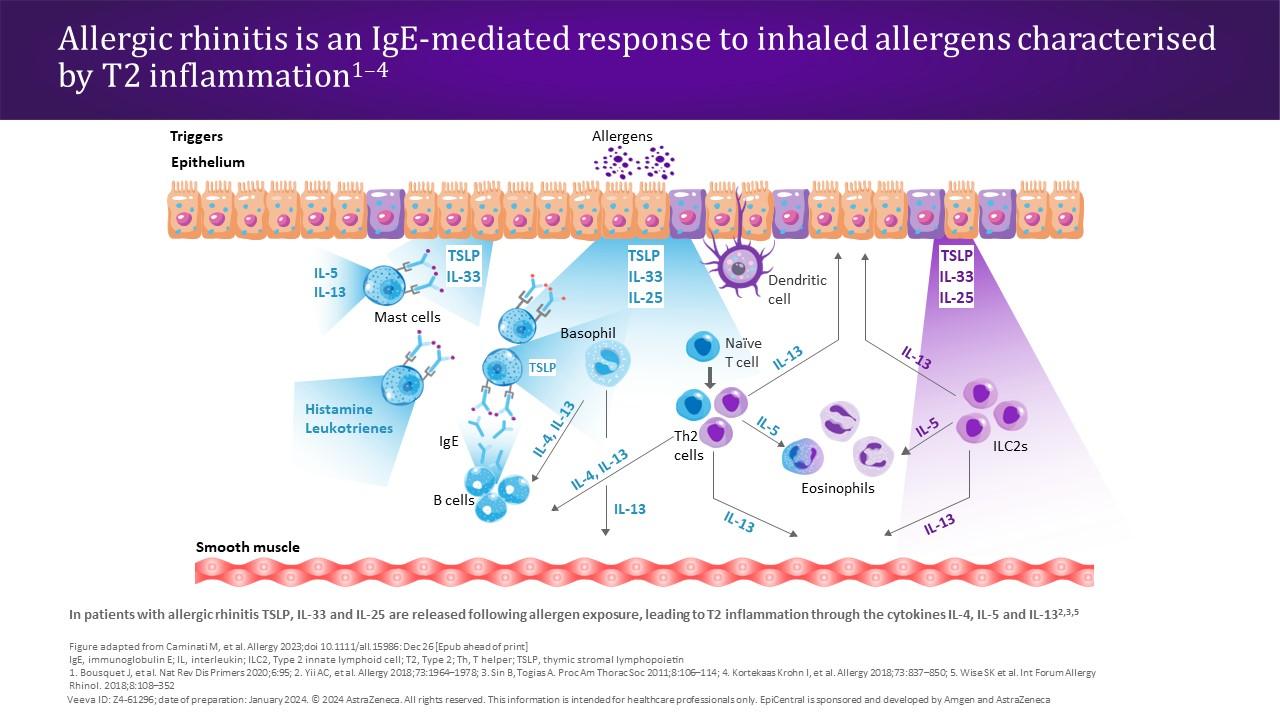 Allergic rhinitis is an IgE-mediated response to inhaled allergens characterised by T2 inflammation