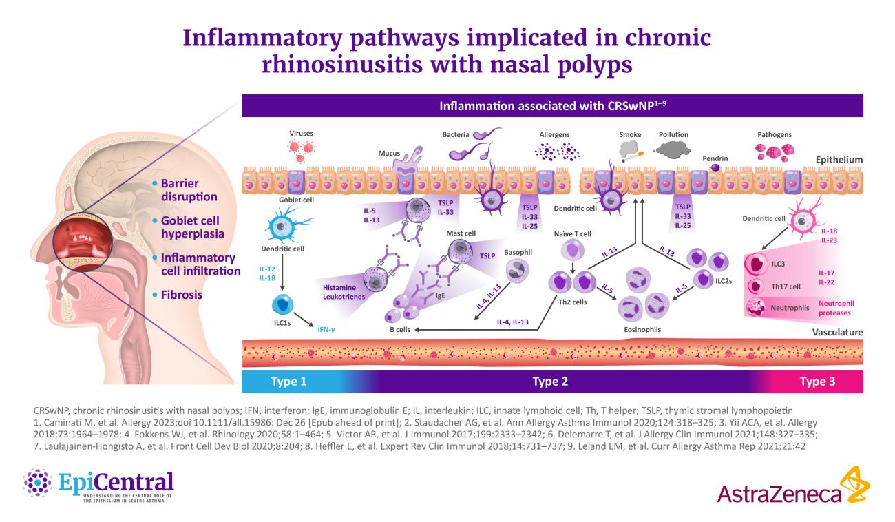 Inflammatory cascade in CRS