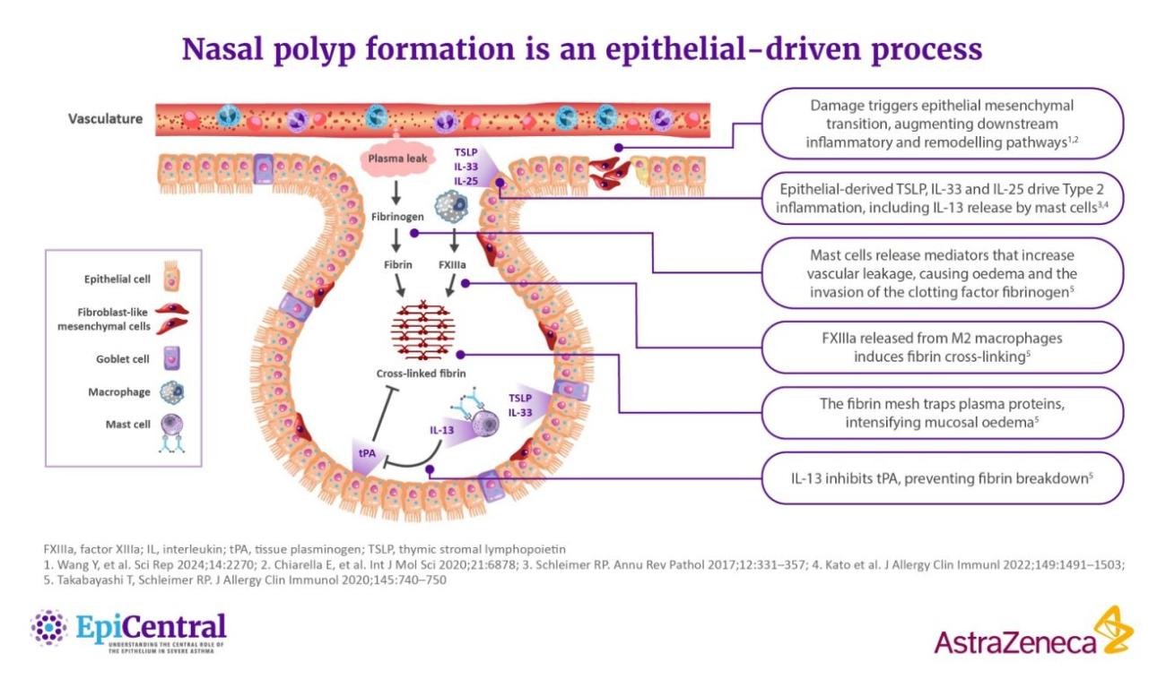 Nasal polyp formation