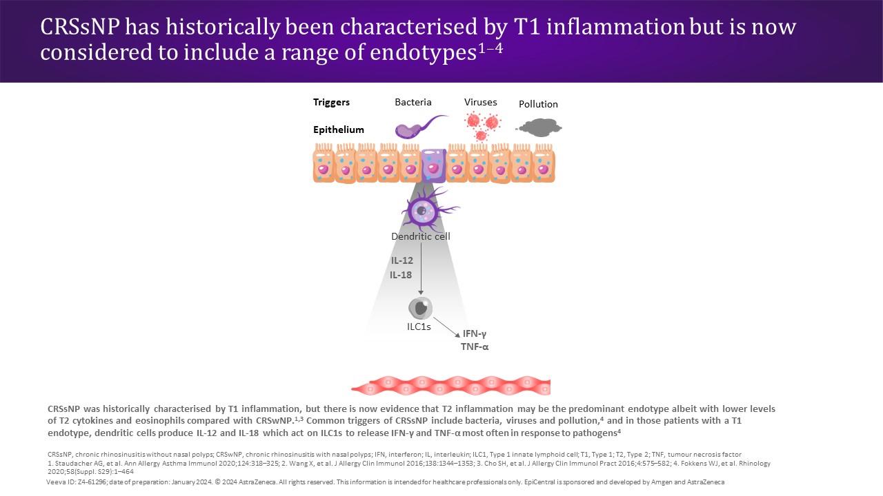 CRSsNP has historically been characterised by T1 inflammation but is now considered to include a range of endotypes